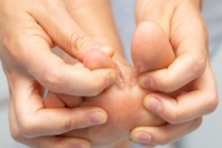 Causes and Symptoms of Athlete’s Foot